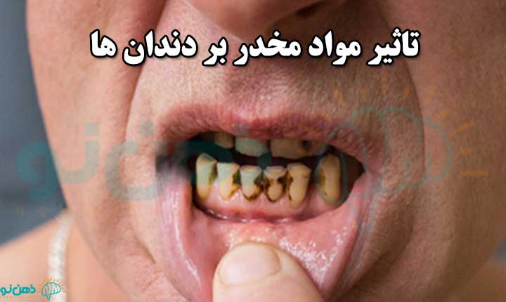 تاثیر مواد مخدر بر دندان ها