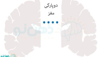 دوپارگی مغز