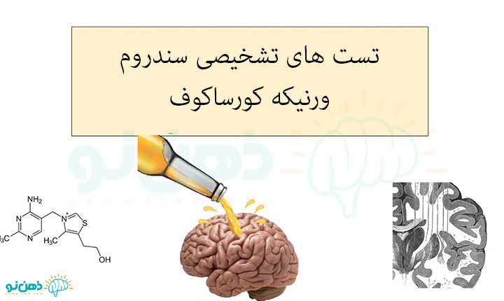 تشخیص سندروم ورنیکه کورساکوف