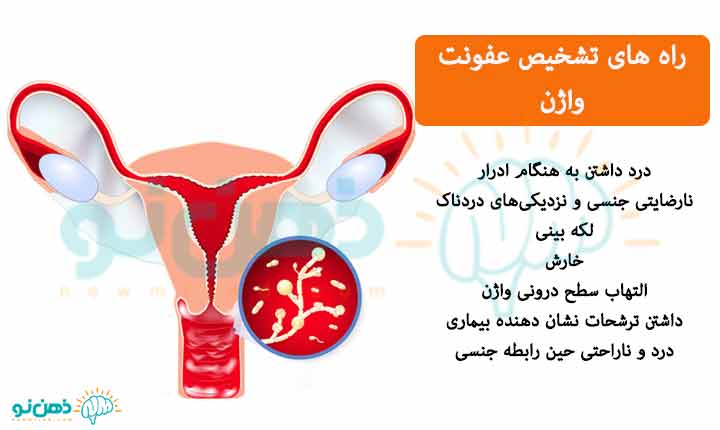 تشخیص عفونت واژن