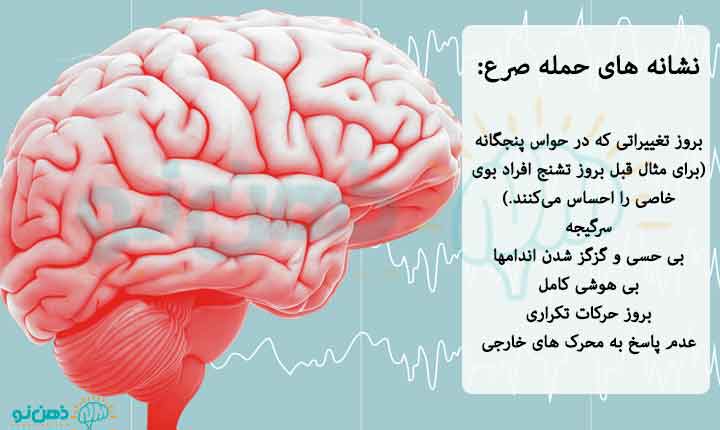 نشانه های حمله صرع