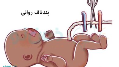 بندناف روانی