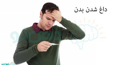 داغ شدن بدن