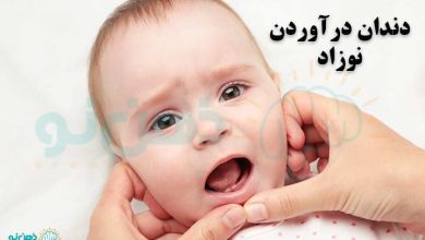 دندان درآوردن نوزاد
