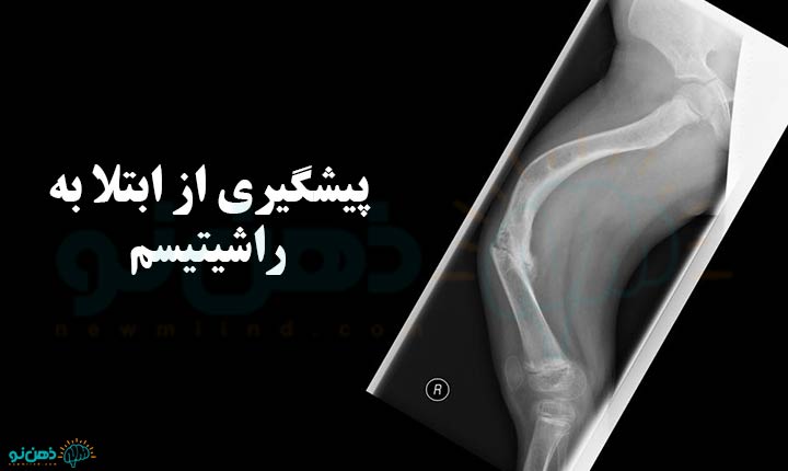 پیشگیری از ابتلا به راشیتیسم