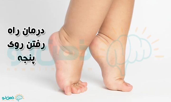 درمان روی پنجه راه رفتن