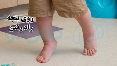 روی پنجه راه رفتن