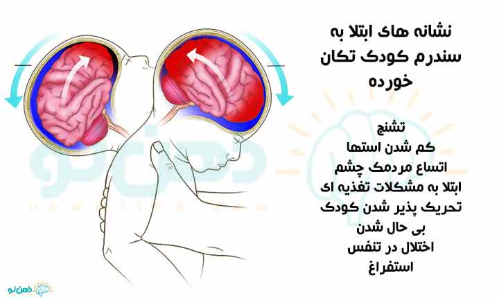 نشانه های ابتلا به این سندرم