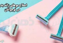 اصلاح موهای زائد بدن در نوجوانان