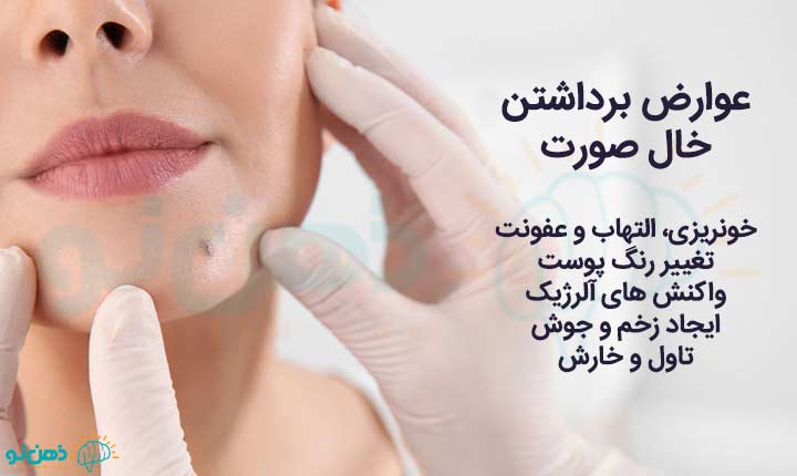 انواع عوارض برداشتن خال صورت