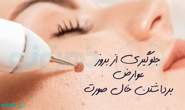 جلوگیری از بروز عوارض برداشتن خال صورت