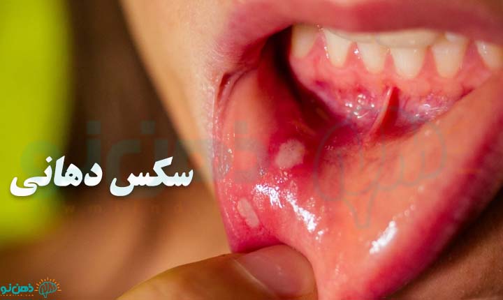 سکس دهانی