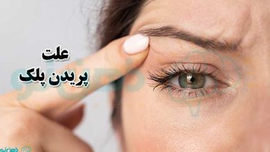 علت پریدن پلک