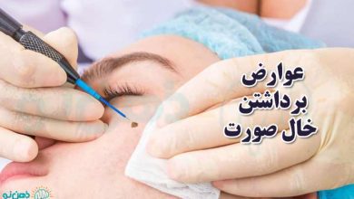عوارض برداشتن خال صورت